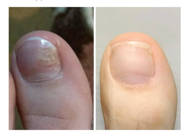 Onistop 15ml