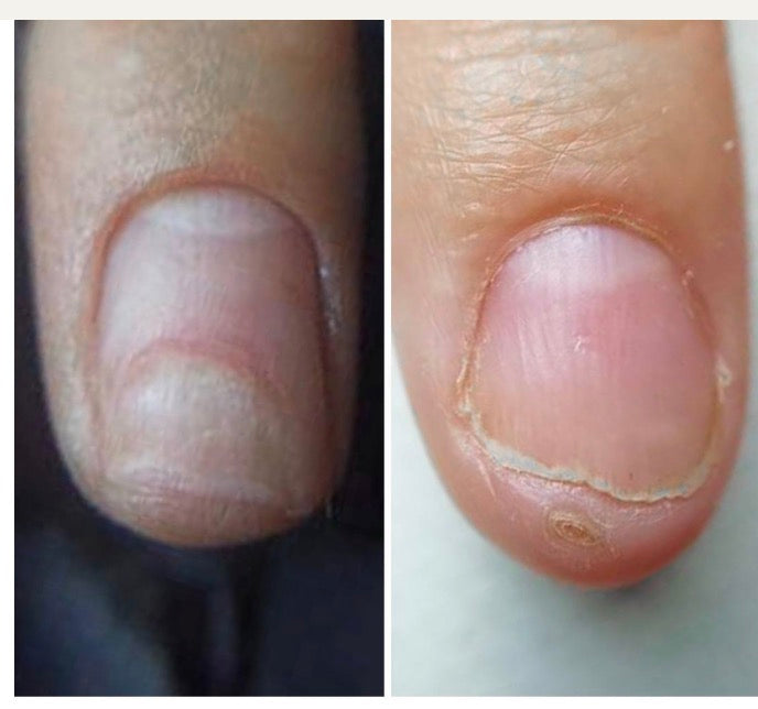 Onistop 15ml